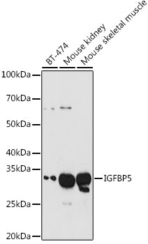 IGFBP5 Rabbit pAb