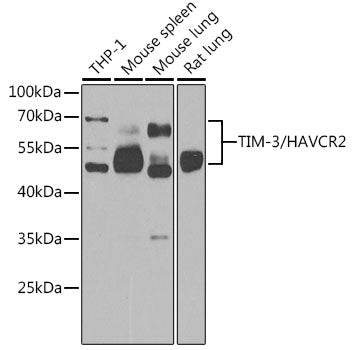 TIM-3/HAVCR2 Rabbit pAb