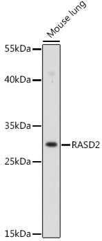 RASD2 Rabbit pAb