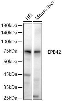 EPB42 Rabbit pAb