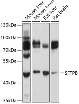 SFTPB Rabbit pAb