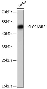 SLC9A3R2 Rabbit pAb