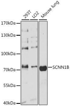 SCNN1B Rabbit pAb
