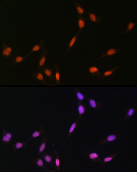 MonoMethyl-Histone H4-K5 Rabbit pAb