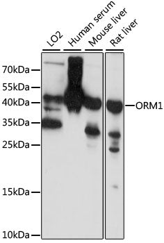 ORM1 Rabbit pAb