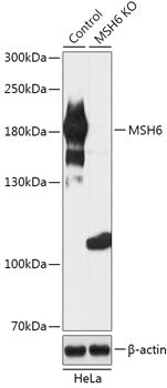 [KO Validated] MSH6 Rabbit pAb