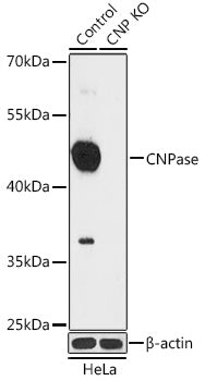 [KO Validated] CNPase Rabbit pAb