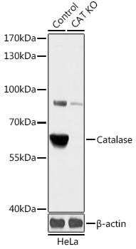 [KO Validated] Catalase Rabbit pAb