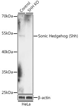 [KO Validated] Sonic Hedgehog (Shh) Rabbit pAb