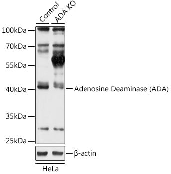 [KO Validated] Adenosine Deaminase (ADA) Rabbit pAb