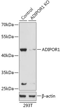 [KO Validated] ADIPOR1 Rabbit pAb