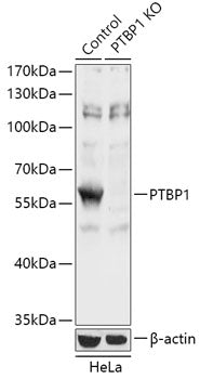 [KO Validated] PTBP1 Rabbit pAb
