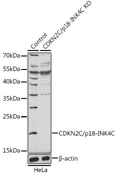 [KO Validated] CDKN2C/p18-INK4C Rabbit pAb