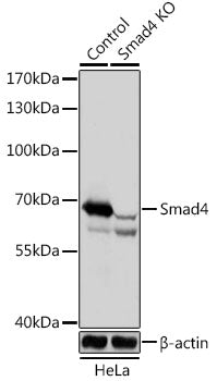 [KO Validated] Smad4 Rabbit pAb