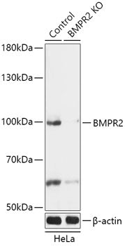 [KO Validated] BMPR2 Rabbit pAb
