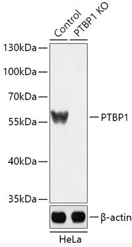 [KO Validated] PTBP1 Rabbit pAb