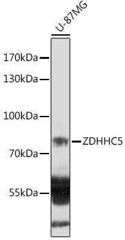 ZDHHC5 Rabbit pAb