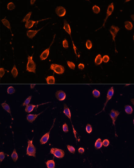 MT-ATP6 Rabbit pAb