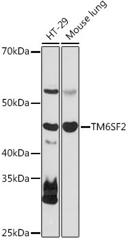TM6SF2 Rabbit pAb