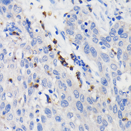 CD11b/ITGAM Rabbit mAb