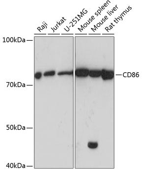 CD86 Rabbit mAb