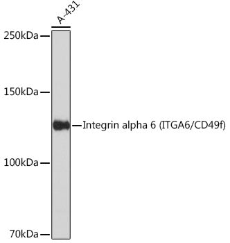 Integrin alpha 6 (ITGA6/CD49f) Rabbit mAb