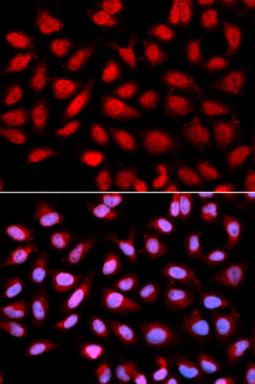 Ser/thr-PP2A activator (PTPA) Rabbit pAb