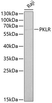 PKLR Rabbit pAb