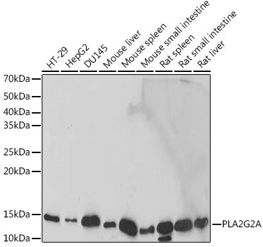 PLA2G2A Rabbit mAb