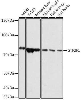 GTF2F1 Rabbit pAb