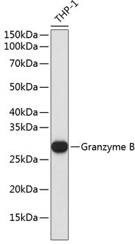 Granzyme B Rabbit mAb