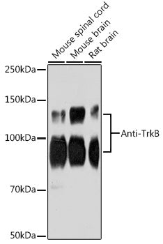 Anti-TrkB Rabbit mAb