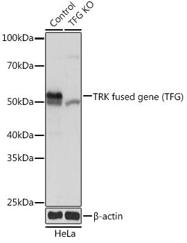 [KO Validated] TRK fused gene (TFG) Rabbit pAb