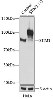 [KO Validated] STIM1 Rabbit pAb