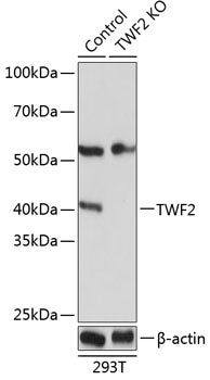 [KO Validated] TWF2 Rabbit pAb