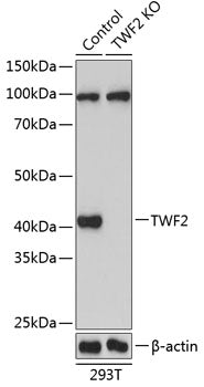 [KO Validated] TWF2 Rabbit pAb