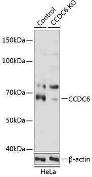 [KO Validated] CCDC6 Rabbit pAb