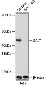 [KO Validated] GALT Rabbit pAb