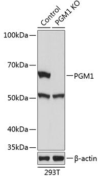 [KO Validated] PGM1 Rabbit pAb