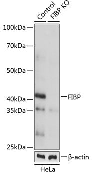 [KO Validated] FIBP Rabbit pAb