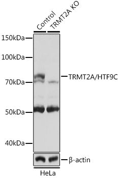 [KO Validated] TRMT2A/HTF9C Rabbit pAb
