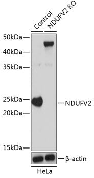 [KO Validated] NDUFV2 Rabbit pAb
