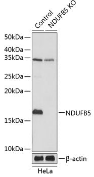 [KO Validated] NDUFB5 Rabbit pAb