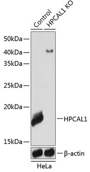 [KO Validated] HPCAL1 Rabbit pAb