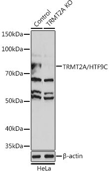 [KO Validated] TRMT2A/HTF9C Rabbit pAb