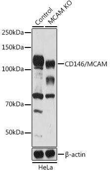 [KO Validated] CD146/MCAM Rabbit pAb