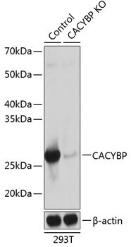 [KO Validated] CACYBP Rabbit pAb