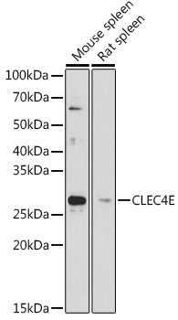 CLEC4E Rabbit pAb