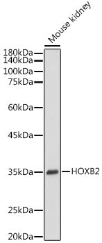 HOXB2 Rabbit pAb