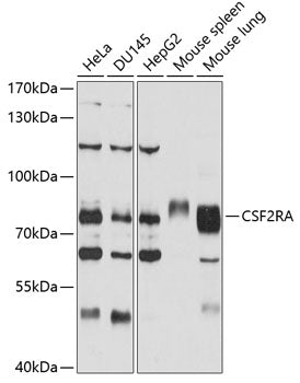CSF2RA Rabbit pAb